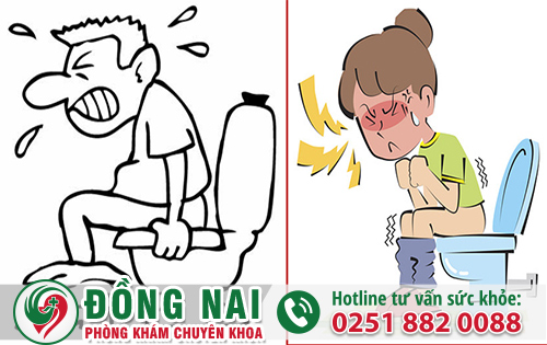 Những điều cần biết về bệnh trĩ